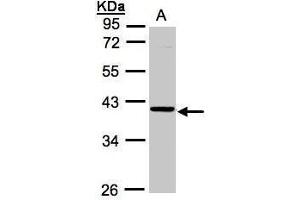 WB Image Sample (30μg whole cell lysate) A:A431, 10% SDS PAGE antibody diluted at 1:1000 (ASB4 Antikörper)