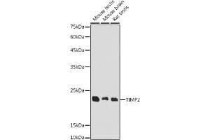 Western blot analysis of extracts of various cell lines, using TIMP2 antibody (ABIN7268483) at 1:1000 dilution. (TIMP2 Antikörper  (AA 100-200))