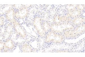 Detection of S100A3 in Human Kidney Tissue using Monoclonal Antibody to S100 Calcium Binding Protein A3 (S100A3) (S100A3 Antikörper  (AA 1-101))