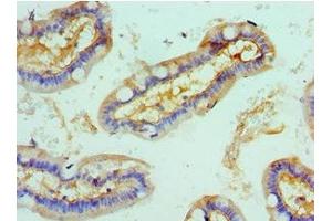 Immunohistochemistry of paraffin-embedded human small intestine tissue using ABIN7168003 at dilution of 1:100 (ROCK2 Antikörper  (AA 1109-1388))