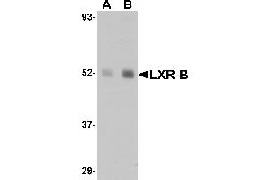 Western blot analysis of LXR-B in human lung tissue lysate with LXR-B antibody at (A) 1 and (B) 2 µg/mL. (NR1H2 Antikörper  (N-Term))