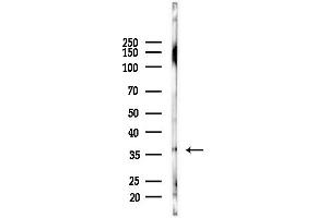 anti-PDZ and LIM Domain 1 (PDLIM1) (Internal Region) antibody