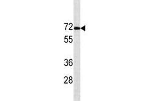 Estrogen Receptor alpha antibody western blot analysis in MCF-7 lysate. (Estrogen Receptor alpha Antikörper  (AA 246-273))