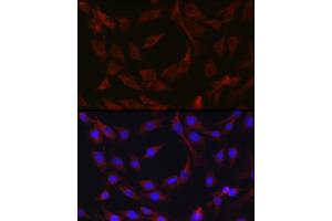 Immunofluorescence analysis of C6 cells using cI Rabbit pAb (ABIN1678920, ABIN3015349, ABIN3015350 and ABIN6213998) at dilution of 1:50 (40x lens). (BIRC3 Antikörper  (AA 1-180))