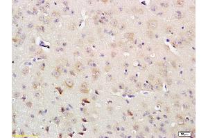Formalin-fixed and paraffin embedded rat brain labeled with Rabbit Anti IRS-4 Polyclonal Antibody, Unconjugated (ABIN726020) at 1:200 followed by conjugation to the secondary antibody and DAB staining (IRS4 Antikörper  (AA 401-500))