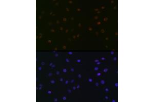 Immunofluorescence analysis of C6 cells using SUPT5H/SPT5 Rabbit mAb (ABIN7270878) at dilution of 1:100 (40x lens). (SUPT5H Antikörper)