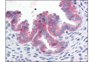 Immunohistochemistry (IHC) image for anti-Met Proto-Oncogene (MET) (Cytoplasmic Domain) antibody (ABIN614469) (c-MET Antikörper  (Cytoplasmic Domain))