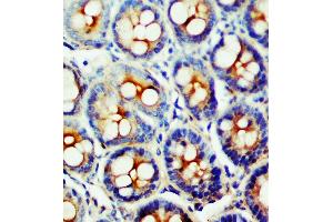 Anti-SSTR1 antibody, IHC(P) IHC(P): Rat Intestine Tissue (SSTR1 Antikörper  (C-Term))
