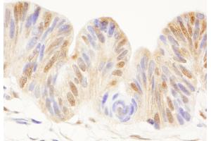 Immunohistochemistry (IHC) image for anti-Cell Division Cycle 25 Homolog C (S. Pombe) (CDC25C) (AA 150-200) antibody (ABIN7454534)