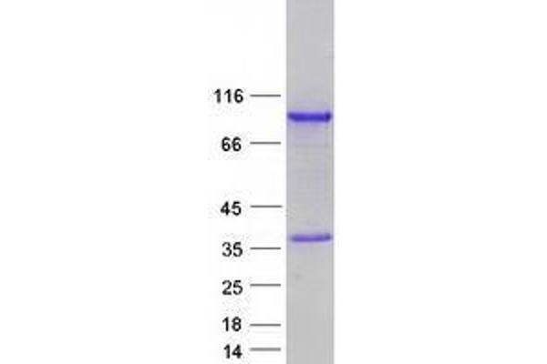 ZNF579 Protein (Myc-DYKDDDDK Tag)