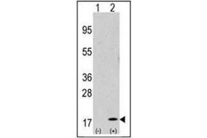 Western Blotting (WB) image for anti-GABA(A) Receptor-Associated Protein (GABARAP) (AA 1-31), (N-Term) antibody (ABIN1449614)
