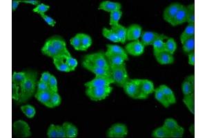 Immunofluorescence staining of HepG2 cells with ABIN7145438 at 1:66, counter-stained with DAPI. (ADRBK2 Antikörper  (AA 343-480))