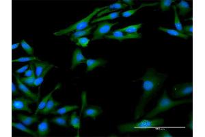 Immunofluorescence of purified MaxPab antibody to PPIA on HeLa cell. (PPIA Antikörper  (AA 1-165))