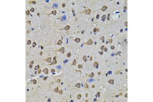 Immunohistochemistry of paraffin-embedded rat brain using N6AMT1 Antibody (ABIN5974334) at dilution of 1/100 (40x lens). (N6AMT1 Antikörper)