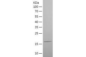 Western Blotting (WB) image for Chemokine (C-X3-C Motif) Ligand 1 (CX3CL1) (AA 76-182) protein (His tag) (ABIN7122345) (CX3CL1 Protein (AA 76-182) (His tag))