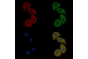 NMDAR2B Mouse Monoclonal Antibody staining Hela cells by IF/ICC. (GRIN2B Antikörper  (C-Term))