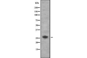 Western blot analysis of AKT1S1 using 293 whole cell lysates (PRAS40 Antikörper  (Internal Region))