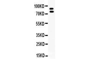 Western blot analysis of MMP-9 expression in NRK whole cell lysates ( Lane 1).