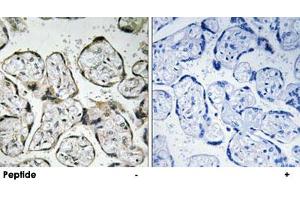 Immunohistochemistry analysis of paraffin-embedded human placenta tissue using MT-ND1 polyclonal antibody . (MT-ND1 Antikörper)