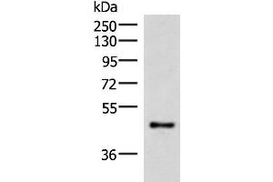 Western blot analysis of Mouse lung tissue lysate using IRX2 Polyclonal Antibody at dilution of 1:300 (IRX2 Antikörper)