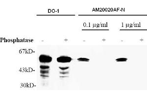 Western Blotting (WB) image for anti-Tumor Protein P53 (TP53) (AA 378-393), (pSer392) antibody (ABIN487475) (p53 Antikörper  (pSer392))