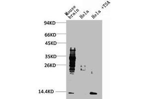 Western blot analysis of 1) Mouse Brain Tissue, 2) Hela, 3) Hela+TSA Treated using Acetyl Lysine Monoclonal Antibody. (Acetylated Lysine Antikörper)