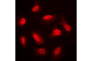 Immunofluorescent analysis of AMPK beta 1 staining in HeLa cells. (PRKAB1 Antikörper  (N-Term))