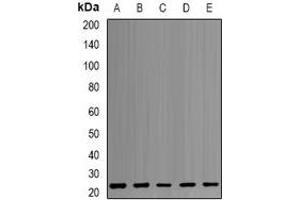 Western blot analysis of PSMB1 expression in MCF7 (A), HepG2 (B), K562 (C), PC3 (D), mouse liver (E) whole cell lysates. (PSMB1 Antikörper)