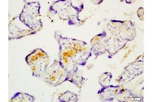 Formalin-fixed and paraffin embedded human placenta tissue with Anti-Fibulin 5 Polyclonal Antibody , Unconjugated at 1:200, followed by conjugation to the secondary antibody and DAB staining (Fibulin 5 Antikörper  (AA 101-200))