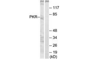 Western blot analysis of extracts from 293 cells, using PKR (Ab-258) Antibody. (EIF2AK2 Antikörper  (AA 226-275))