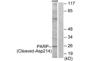 Western blot analysis of extracts from A549 cells, treated with etoposide (25uM, 24hours), using PARP (Cleaved-Asp214) antibody. (PARP1 Antikörper  (Cleaved-Asp214))