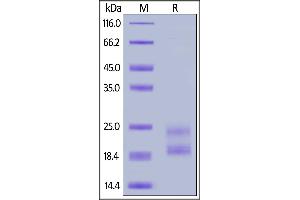 SDS-PAGE (SDS) image for Interleukin 17A (IL17A) (AA 24-155) (Active) protein (His tag,AVI tag,Biotin) (ABIN6810035)