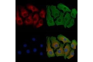 ABIN6257471 and ABIN6274750 staining Hela cells by IF/ICC. (RPS18 Antikörper  (C-Term))