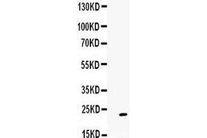 Observed bind size: 23KD (GREM1 Antikörper  (C-Term))