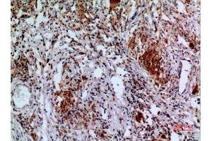 Immunohistochemistry (IHC) analysis of paraffin-embedded Human Lung, antibody was diluted at 1:100. (APAF1 Antikörper  (Internal Region))