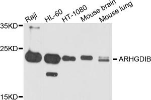 Western blot analysis of extracts of various cell lines, using ARHGDIB antibody (ABIN5971929) at 1/1000 dilution. (ARHGDIB Antikörper)