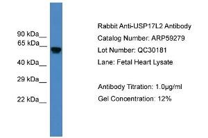 WB Suggested Anti-USP17L2  Antibody Titration: 0. (USP17L2 Antikörper  (Middle Region))