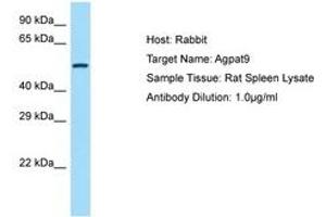Image no. 1 for anti-1-Acylglycerol-3-Phosphate O-Acyltransferase 9 (AGPAT9) (AA 251-300) antibody (ABIN6749916) (AGPAT9 Antikörper  (AA 251-300))