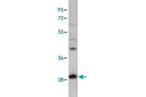 Western blot analysis of mouse cerebellum tissue lysates with PPT1 polyclonal antibody . (PPT1 Antikörper  (N-Term))