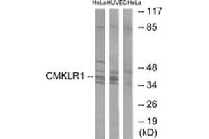 Western blot analysis of extracts from HeLa/HuvEc cells, using CMKLR1 Antibody. (CMKLR1 Antikörper  (AA 221-270))