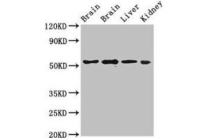 Western Blot Positive WB detected in: Rat brain tissue, Mouse brain tissue, Mouse liver tissue, Mouse kidney tissue All lanes: PPP2R2A antibody at 3 μg/mL Secondary Goat polyclonal to rabbit IgG at 1/50000 dilution Predicted band size: 52, 53 kDa Observed band size: 52 kDa (PPP2R2A Antikörper  (Regulatory Subunit B))