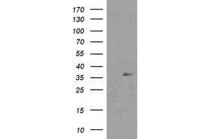 Western Blotting (WB) image for anti-Nudix (Nucleoside Diphosphate Linked Moiety X)-Type Motif 6 (NUDT6) antibody (ABIN1499867) (NUDT6 Antikörper)