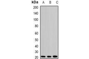 Western blot analysis of H-Ras expression in SKOV3 (A), mouse kidney (B), rat brain (C) whole cell lysates. (HRAS Antikörper)
