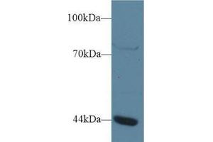 Western blot analysis of Human Jurkat cell lysate, using Human GTF3A Antibody (1 µg/ml) and HRP-conjugated Goat Anti-Rabbit antibody ( (GTF3A Antikörper  (AA 71-365))