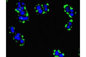 Immunofluorescent analysis of PC-3 cells using ABIN7173297 at dilution of 1:100 and Alexa Fluor 488-congugated AffiniPure Goat Anti-Rabbit IgG(H+L) (TMEM95 Antikörper  (AA 17-145))