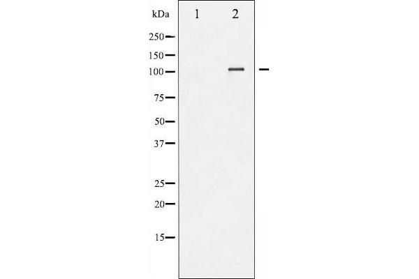 NFATC3 Antikörper  (pSer165)
