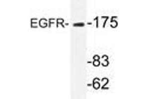 Western blot analyzes of EGFR antibody in extracts from HeLa cells. (EGFR Antikörper)