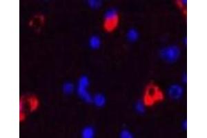 Immunofluorescence analysis of Mouse brain tissue using MAP2 Monoclonal Antibody at dilution of 1:200. (MAP2 Antikörper)