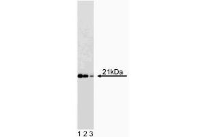 Western blot analysis of Cip1 on a WI-38 cell lysate (Human lung fibroblasts, ATCC CCL-75). (SLC12A9 Antikörper  (AA 1-150))