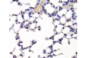 Immunohistochemistry of paraffin-embedded Mouse lung using INTS6 Polyclonal Antibody at dilution of 1:100 (40x lens). (INTS6 Antikörper)
